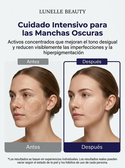 Crema Unificante con Ácido Tranexámico